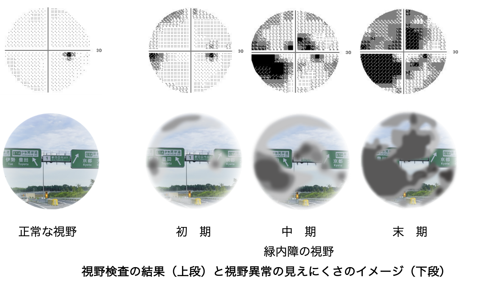 視野